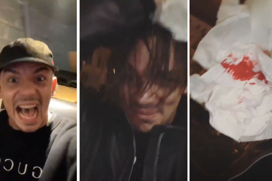 Blutiges Ende einer kleinen Rap-Session: Capital Bra sorgt für Instgram-Lacher! (Bildmontage)