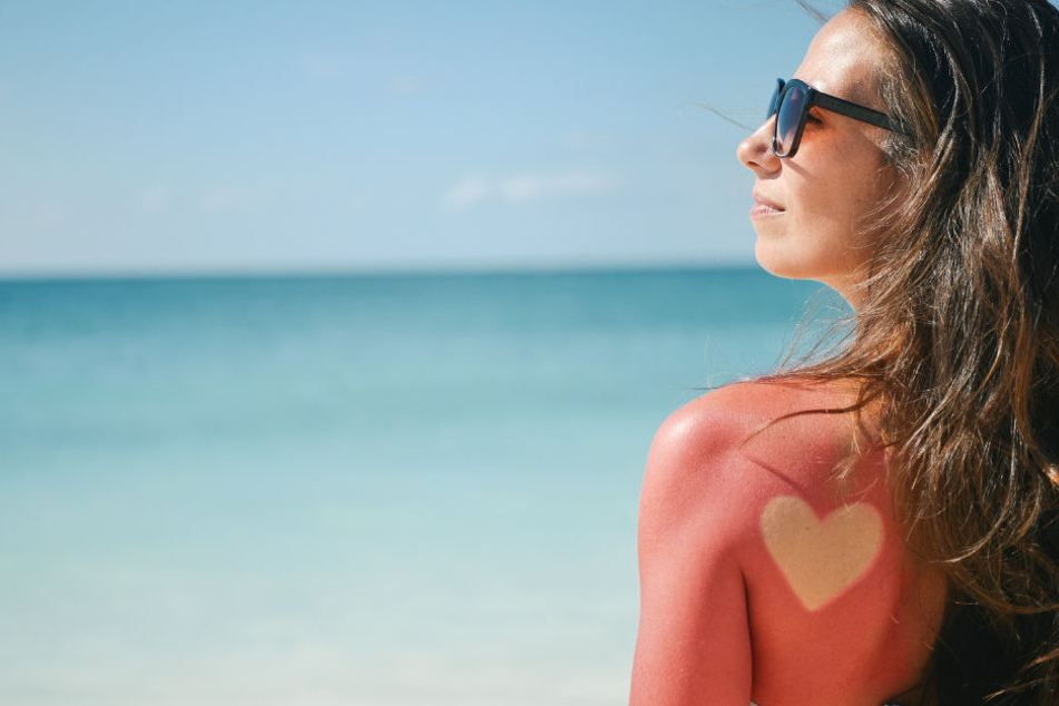 Nicht nachmachen! Sonnenbrand-Tattoos sind gefährlich.