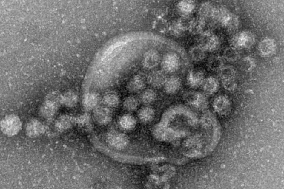 Im Vogtland und in Westsachsen geht das Norovirus um.