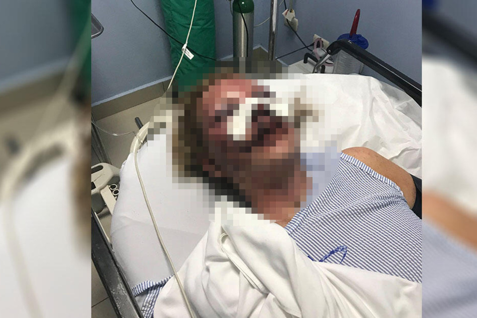 Die 51-Jährige postete auf Facebook schreckliche Bilder, auf denen sie blutüberströmt im Krankenhaus liegt.