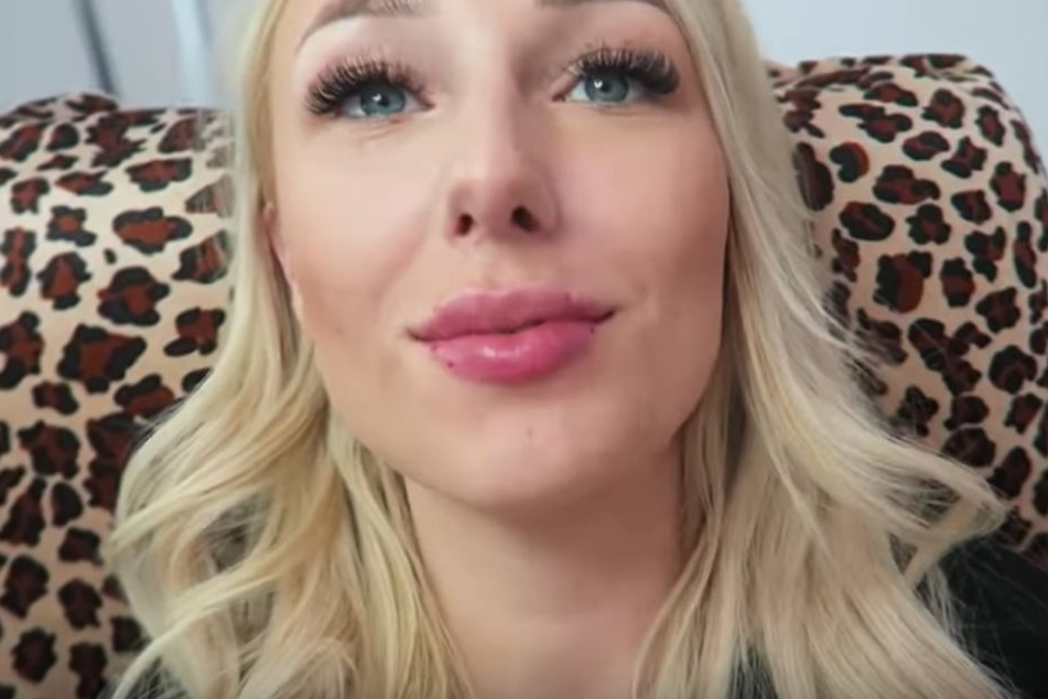 Stolz präsentiert Jessi ihren Followern die frisch aufgespritzten Lippen.