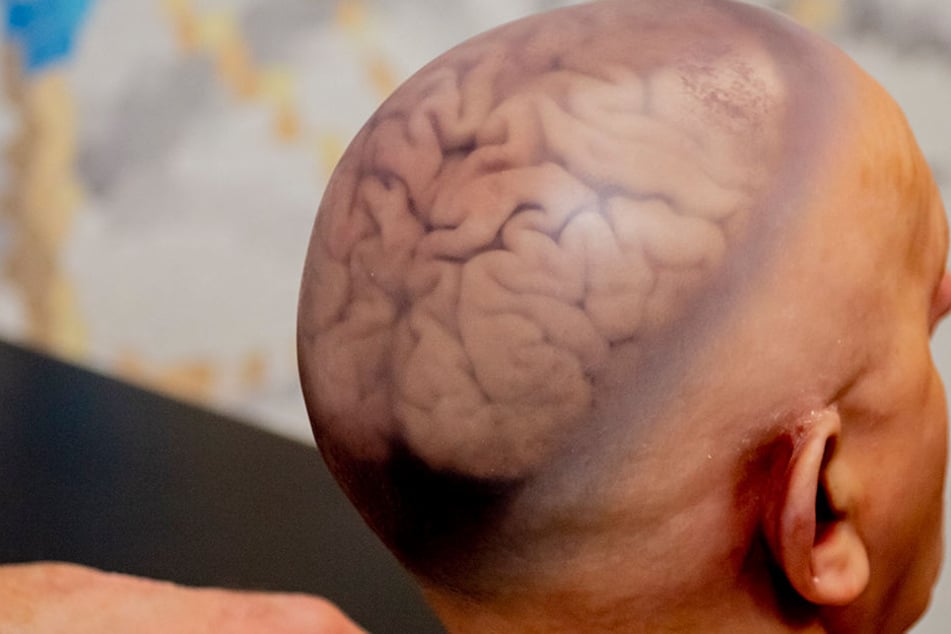   Doctors have scanned many brains - with surprising results. 