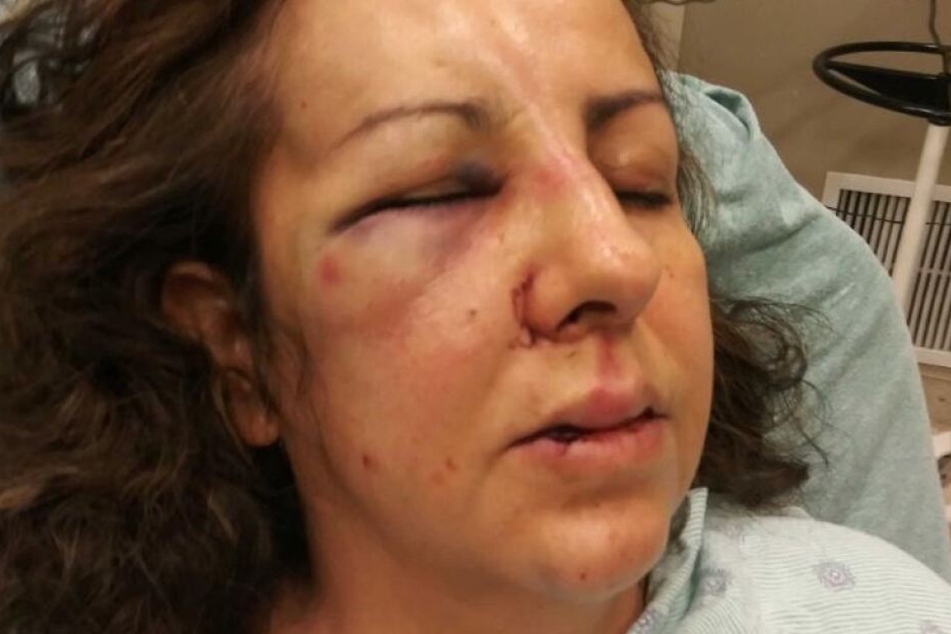 Maria Guadalupe Jimenez im Krankenhaus.