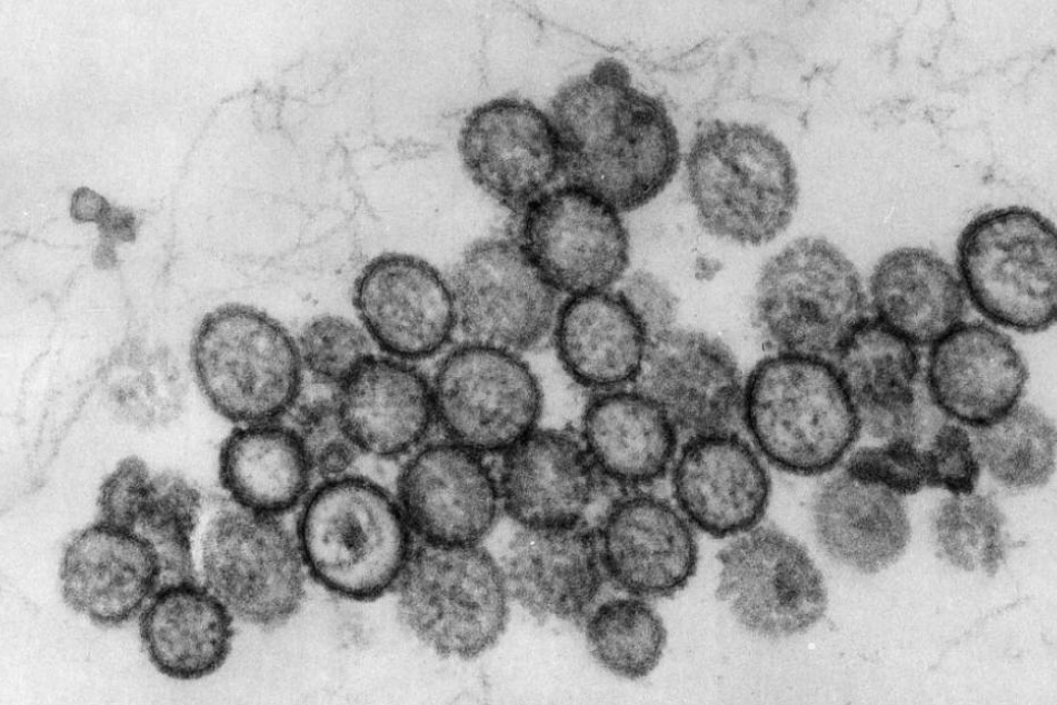 Der Virus kann hohes Fieber verursachen und zum Nierenversagen führen.