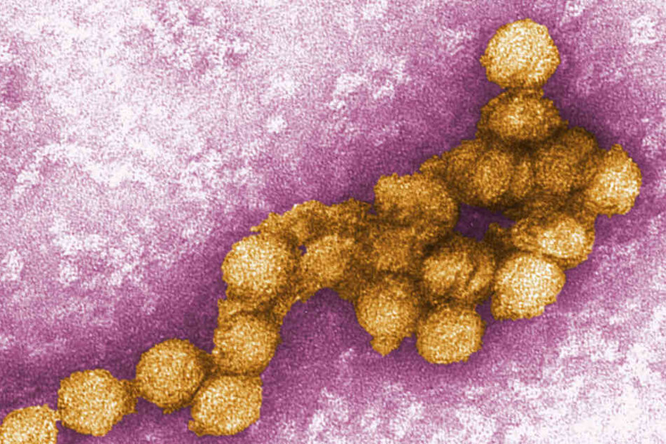Eine elektronenmikroskopische Aufnahme des West-Nil-Virus.