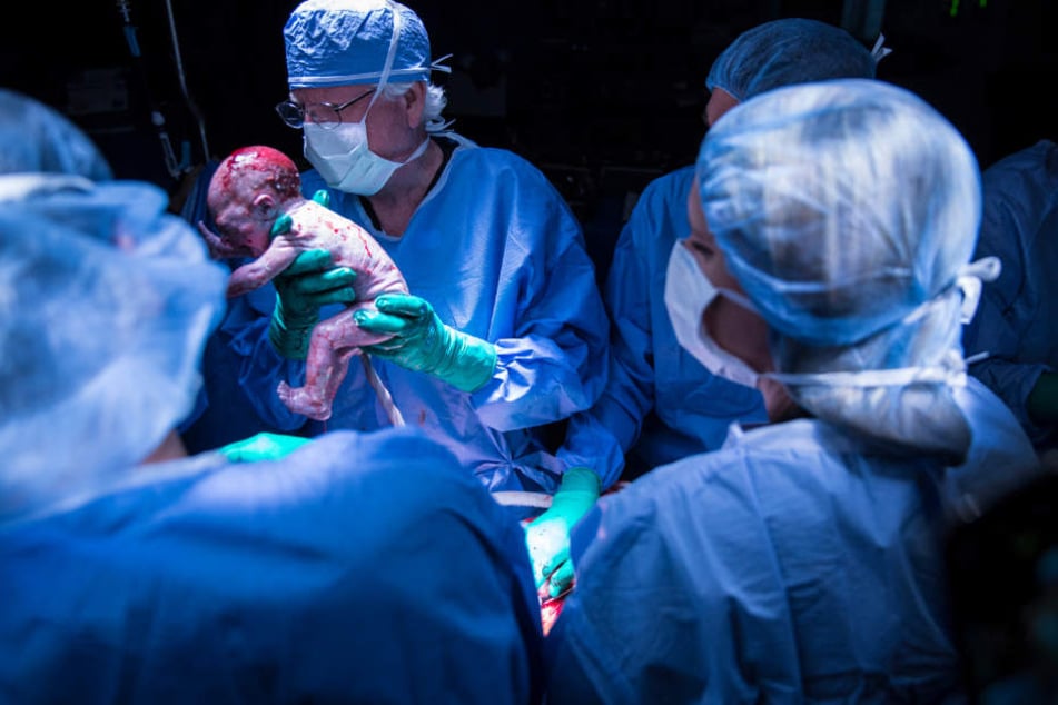Dieses Baby kam in den USA als erstes Kind zur Welt, das nach einer Gebärmutter-Transplantation entbunden wurde. Weltweit ist es das Neunte.