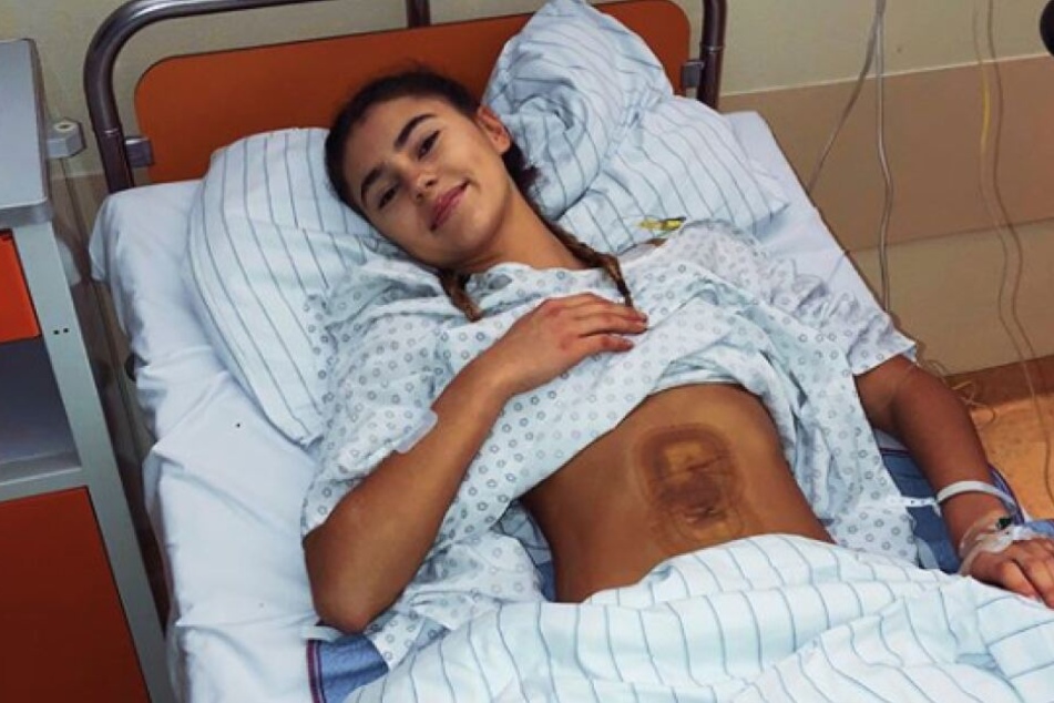 Das Model leidet am unheilbaren Kartagener-Syndrom.
