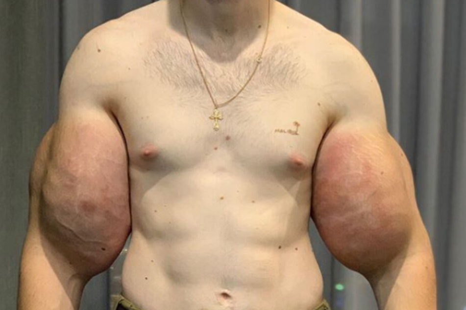 Oberarme und Körper standen in einem völlig unrealistischen Verhältnis zueinander.