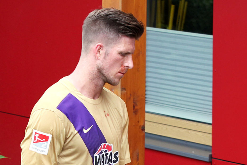 Dennis Kempe musste in Rosenheim mit einem blutverschmierten Gesicht raus.