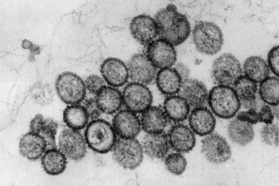 Das Virus wird überwiegend von Nagetieren übertragen.