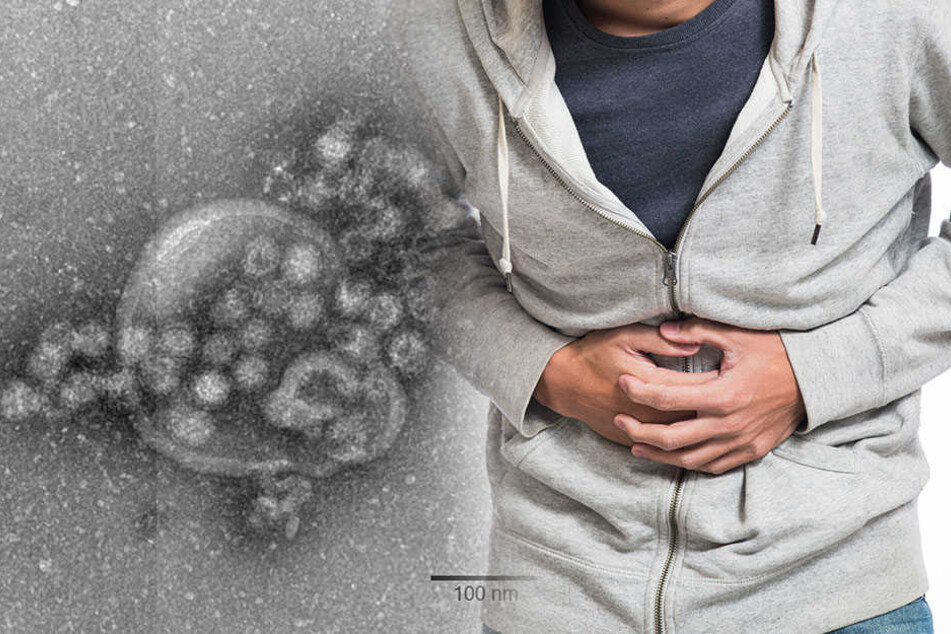 Allein 1302 Patienten steckten sich mit dem Norovirus an. (Symbolbild)