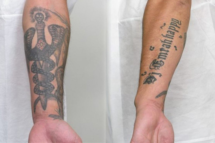 Der Verdächtige hat auffällige Tattoos.