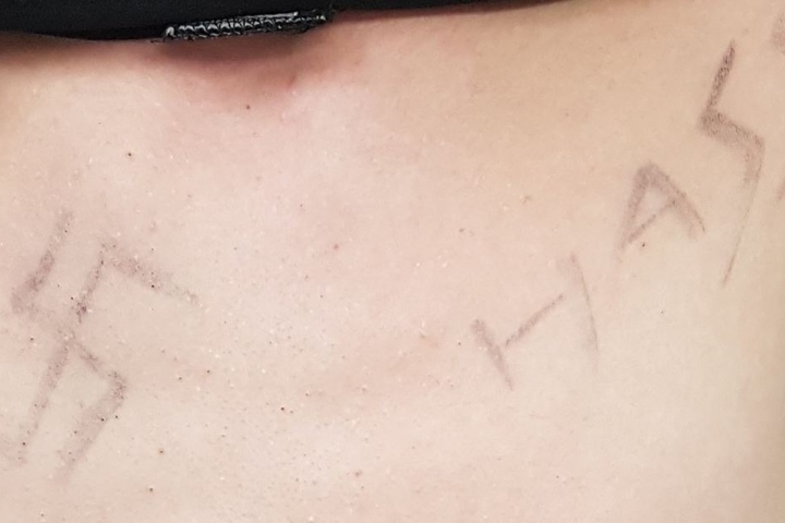 Auch Hakenkreuze hatten sich die beiden polizeibekannten auf den Körper geschmiert.