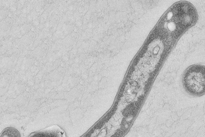 Der Tuberkulose-Erreger kann bei einem geschwächten Immunsystem durchaus gefährlich werden. In der Regel kann er per Antibiotika behandelt werden.