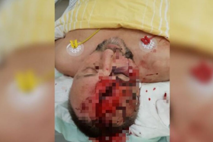 Die AfD verbreitete direkt nach dem Vorfall ein Foto, das den verletzten Frank Magnitz im Krankenhaus zeigen soll.