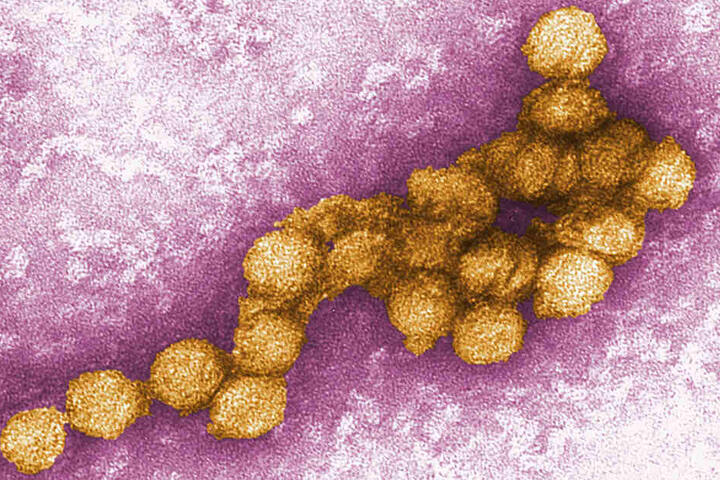 Dieses von den Centers for Disease Control am 22.08.2012 zur Verfügung gestellte Foto zeigt eine elektronenmikroskopische Aufnahme des West-Nil-Virus.
