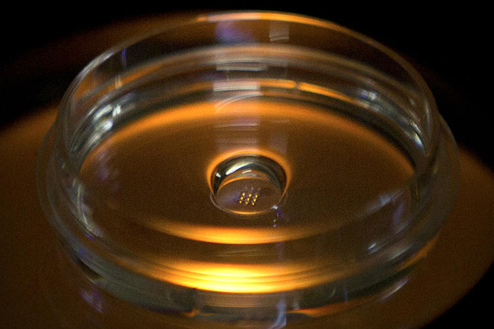 Eine Mikroplatte mit Embryonen, die mit Cas9-Protein und PCSK9 sgRNA injiziert wurden, ist in einem Labor in Shenzhen in der südchinesischen Provinz Guangdong zu sehen.