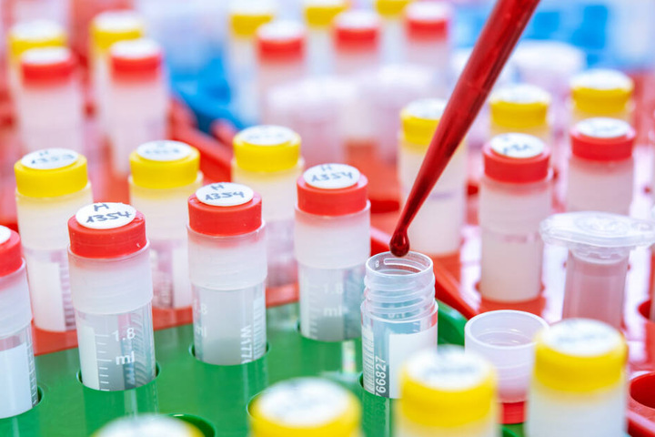 Nach dem PR-Desaster seien laut Bruwinkel mögliche Investoren und die Wissenschaftsgemeinde von dem Bluttest abgeschreckt worden.