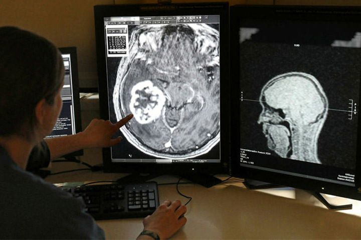 Im MRT-Bild wird ein Tumor sichtbar. Fortan sollen Onkologen und Krankenhäuser über das Tumornetzwerk ihre Befunde an ein Kompetenzzentrum senden können und von dort Therapievorschläge erhalten.