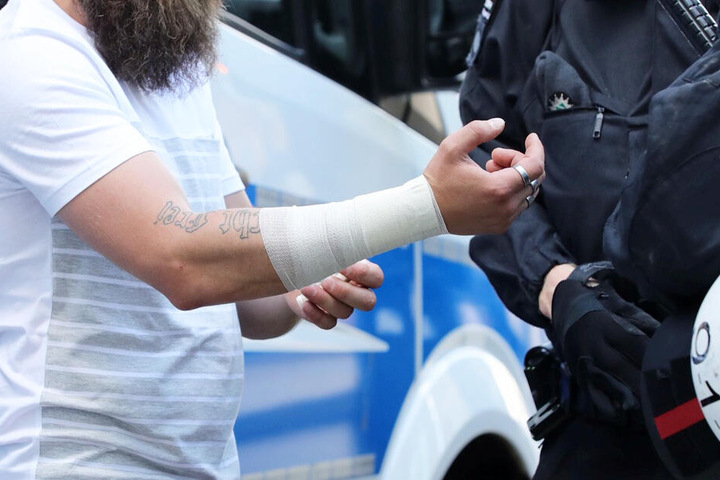 Der Mann mit dem Tattoo musste es in Gegenwart der Polizei abbinden.