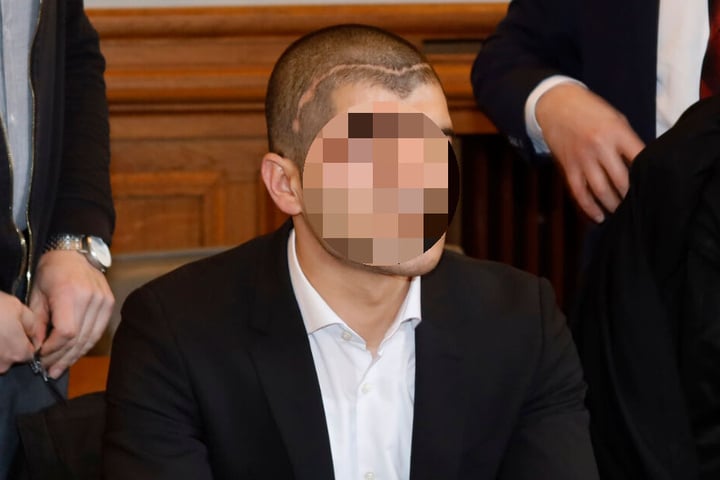 Das Opfer mit der großen Narbe: Ahmed Ö. (28) wurde mit einer Pistole in den Kopf geschossen.