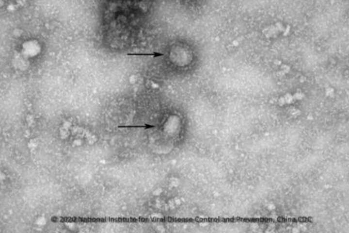 Bislang sind in Verbindung mit dem Coronavirus 56 Todesfälle bestätigt.
