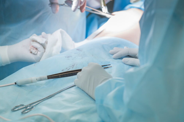 Ein Arzt soll an der OP von 64 Patienten beteiligt gewesen sein, obwohl er keine Zulassung hatte. (Symbolbild) J