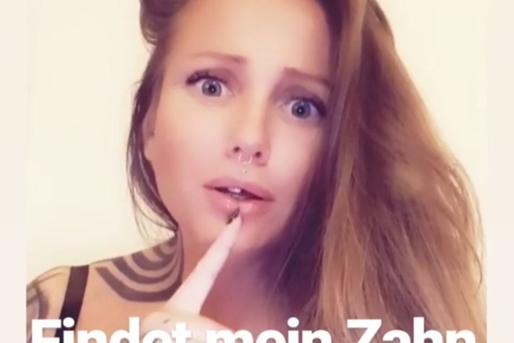 Die Rapperin zeigte sich ihren Fans mit einem fehlenden Schneidezahn.