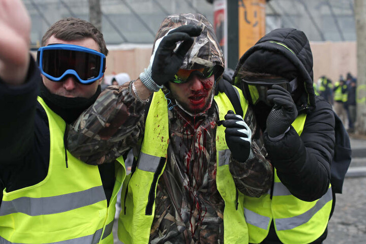 Ein Demonstrant der "Gilets Jaunes" (Gelbwesten) ist mit Blut beschmiert, nachdem er beim Protest verletzt wurde.
