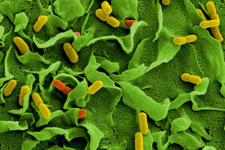Elektronenmikroskopische Aufnahmen von Listerien (Listeria monocytogenes) auf der Oberfläche einer dendritischen Zelle.