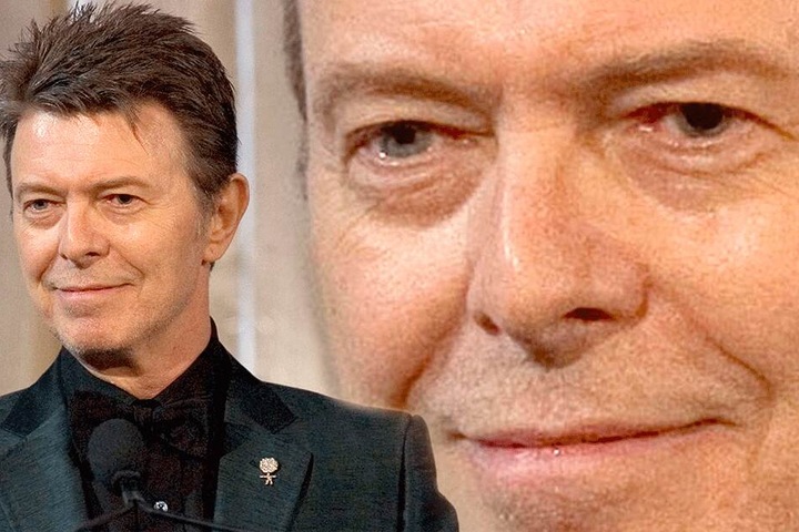 David Bowie (†69) hatte ebenfalls verschiedenfarbige Augen.