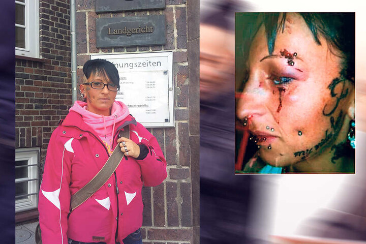 Blutige Wunden im Gesicht und ein dickes Veilchen am Auge: Opfer Nicole Leuchtmann (30) soll von Fahri A. krankenhausreif geschlagen worden sein.