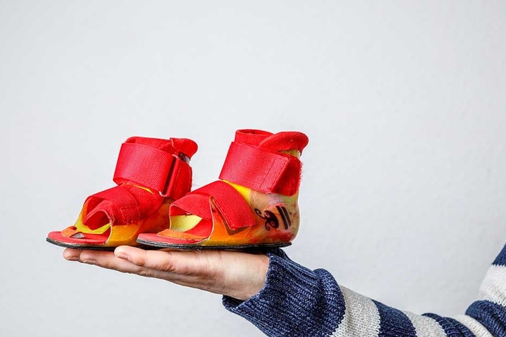 Die Krankheit verschlingt Unsummen: Diese Spezial-Schuhe für rund 1800 Euro finanzierte die Krankenkasse für Elena.