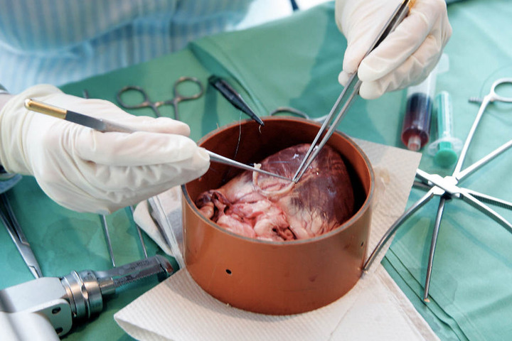 Mehreren Pavianen wurde jeweils ein genetisch verändertes Schweineherz transplantiert. (Symbolbild)