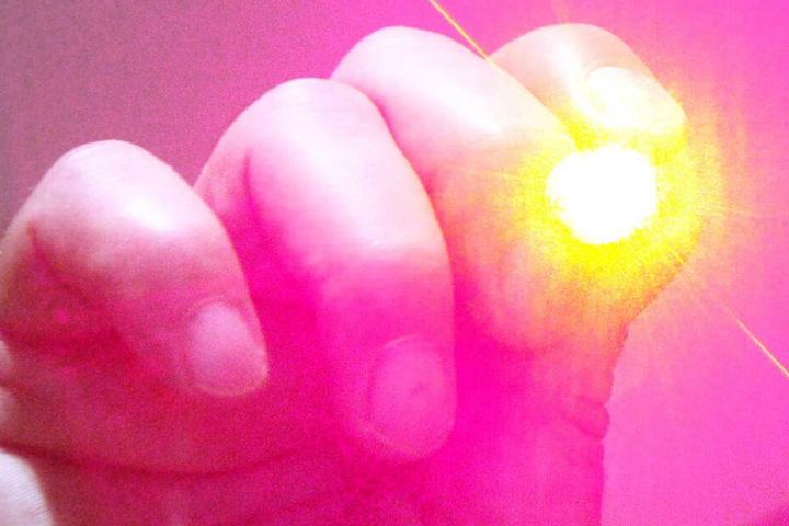 Ein Laserpointer verletzte den Jungen so sehr, dass er stationär in einem Krankenhaus aufgenommen werden musste. (Symbolbild)