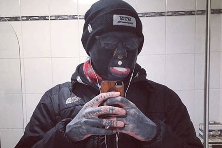 Die schwarze Sonnenbrille verbirgt es, doch auf anderen Fotos kann man die schwarzen Augen sehen.