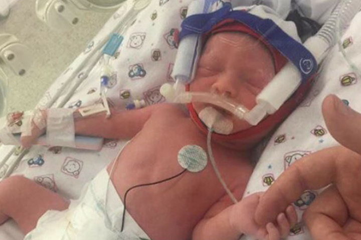 Eleanor kam per Kaiserschnitt zur Welt, bevor ihre Mama starb.