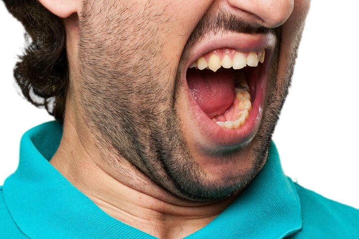 Als die Frau ihn nicht nach Hause fuhr, biss der Mann sie in die Nase und flüchtete. (Symbolbild)