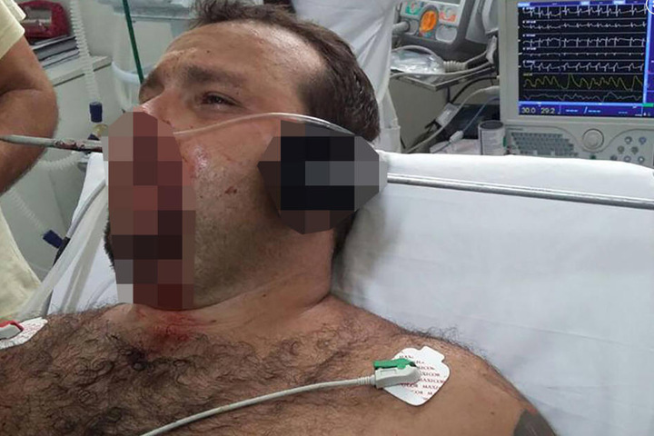 Der 27-Jährige wurde operiert und überlebte den Unfall.