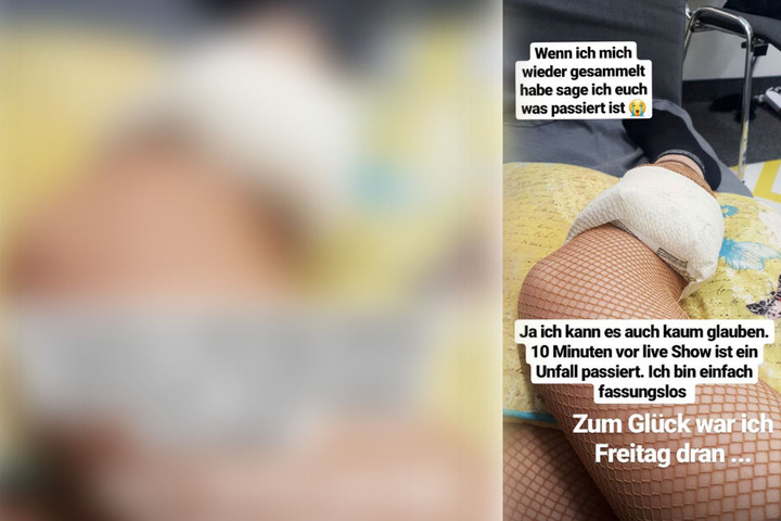Klaudia Giez kühlt ihr geprelltes Schienbein.