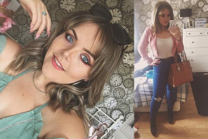 Elisabeth Jobson (23) ist heute nicht mehr wiederzuerkennen.