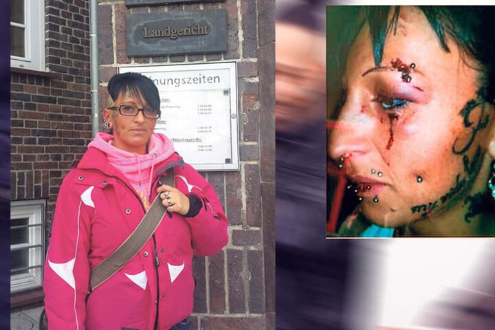 Opfer Nicole Leuchtmann (30) hatte lange mit den Folgen zu kämpfen.