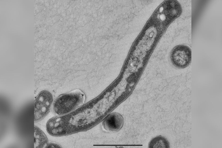 Ein Tuberkulosebakterium stark vergrößert. In Deutschland wurde die Krankheit im vergangen Jahr 6000 diagnostiziert.