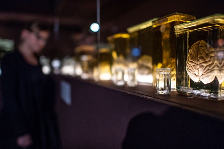 Eine Ausstellung in Münster drehte sich rund um das Gehirn.