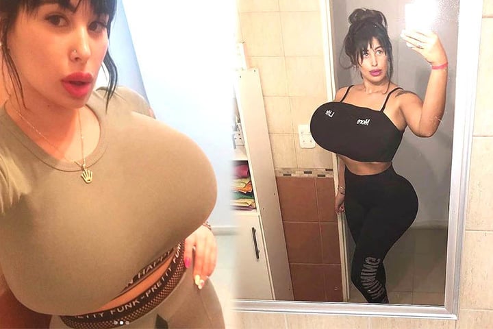 Nadia Sofia Nahir (24) hatte schon die ein oder andere Brust-Op.