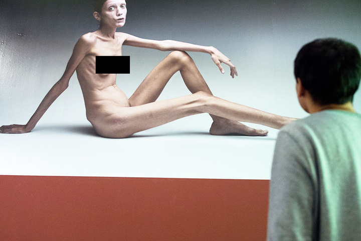 Model Isabelle Caro postet fürs Plakat der Werbekampagne "No-Anorexia".