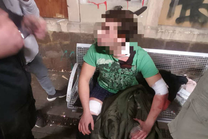 Auf diesen 17-Jährige wurde offenbar im Streit um ein Mädchen von seinem 16 Jahre alten Nebenbuhler eingestochen.