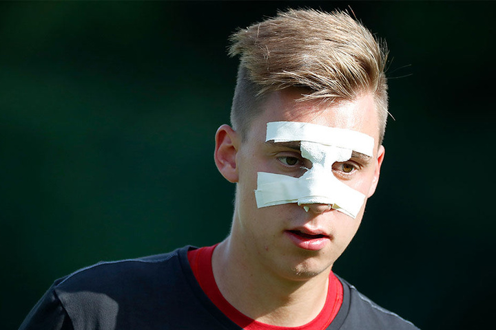 CFC-Torwart Kevin Tittel hat trotz bandagierten Nase den vollen Durchblick.