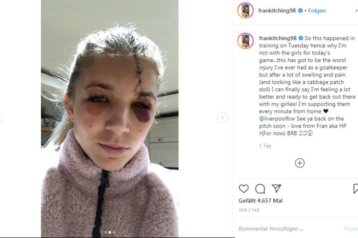 Auuuutsch. Fran Kitching sichtlich gezeichnet von ihrem Trainings-Crash.
