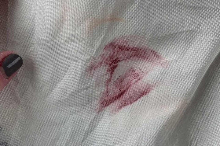 Der Airbag bekam einiges vom Lippenstift ab.